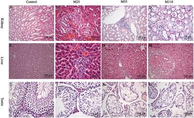 Corrigendum: Mequindox Induced Genotoxicity and Carcinogenicity in Mice